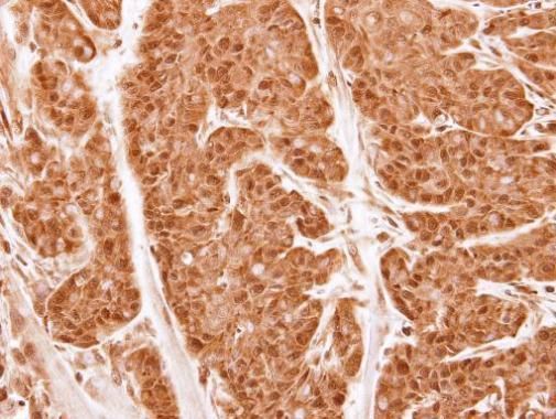 Proteasome 20S alpha 2 Rabbit Polyclonal Antibody