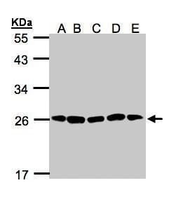 Proteasome 20S alpha 2 antibody