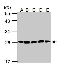 Proteasome 20S alpha 2 Rabbit Polyclonal Antibody