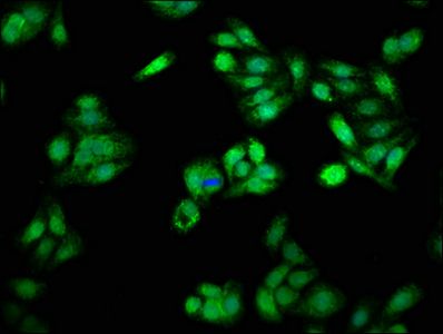 Proteasome activator complex subunit 3 antibody