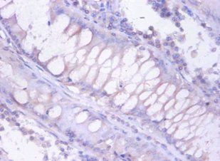 PSMB4 Antibody