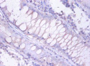 Proteasome subunit beta type-4 antibody