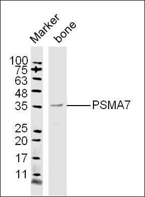 Proteasome 20S alpha 7 antibody