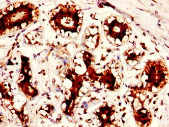 Protein-arginine deiminase type-2 antibody