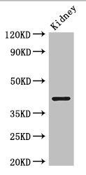 PRMT1 Antibody