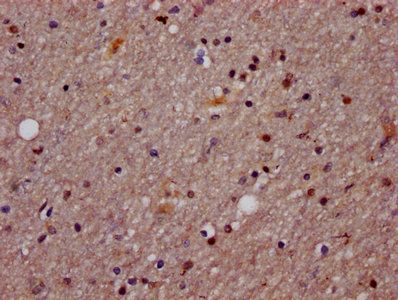 AGO2 Antibody