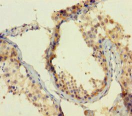 Protein atonal homolog 1 antibody