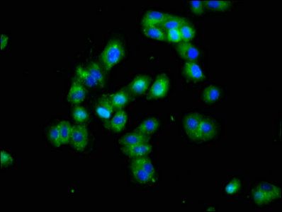 Protein delta homolog 1 antibody