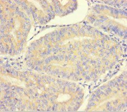 LMAN1L Antibody