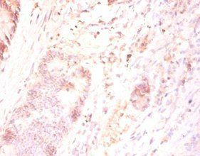 FAM110B Antibody