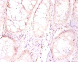 FAM110B Antibody