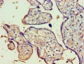 FAM160B1 Antibody