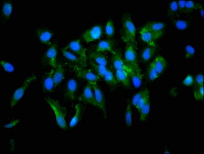 TGM2 Antibody