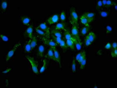 Protein-glutamine gamma-glutamyltransferase 2 antibody