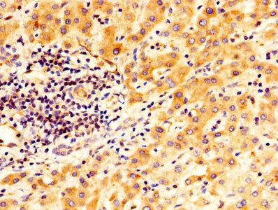 Protein-glutamine gamma-glutamyltransferase 2 antibody