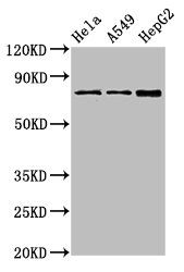 Protein-glutamine gamma-glutamyltransferase 2 antibody