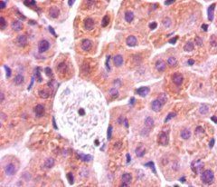 LOX Antibody