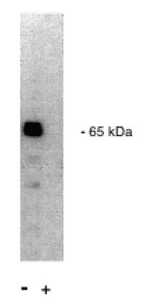 Rabbit anti Human Protein Phosphatase 2 A/A Antibody