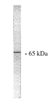 Sheep anti Human Protein Phosphatase 2 A/A Antibody