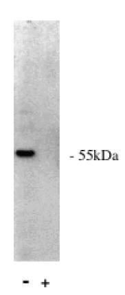 Rabbit anti Human Protein Phosphatase 2 A/B alpha Antibody