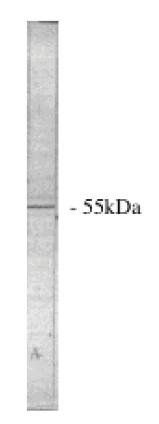 Sheep anti Human Protein Phosphatase 2 A/B alpha Antibody