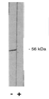 Rabbit anti Human Protein Phosphatase 2 A/B (B' pan 2) Antibody