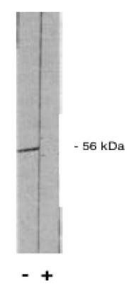 Sheep anti Human Protein Phosphatase 2 A/B (B' pan 2) Antibody