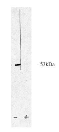 Rabbit anti Human Protein Phosphatase 2 A/B beta Antibody