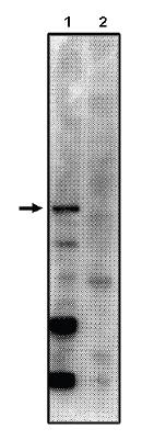 Rabbit anti Human Protein Phosphatase 2 A/B gamma Antibody