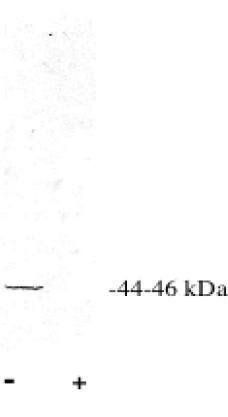 Rabbit anti Human Protein Phosphatase 2 C alpha/beta Antibody