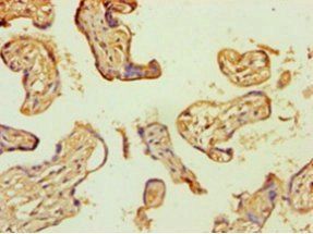 S100A4 Antibody