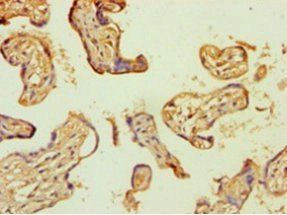 Protein S100-A4 antibody