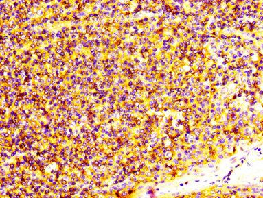 S100A4 Antibody