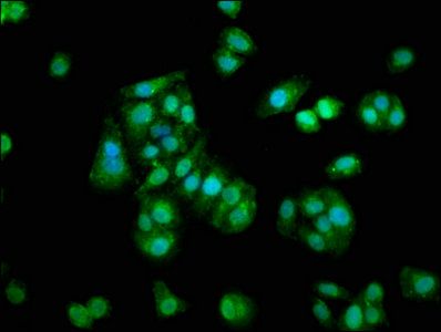 Protein S100A1 antibody