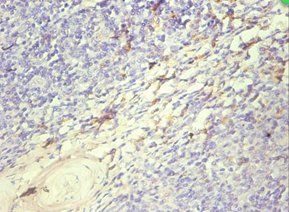 S100a8 Antibody
