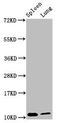 Protein S100A8 antibody