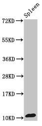 Protein S100A8 antibody