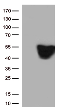 Prothrombin Antibody