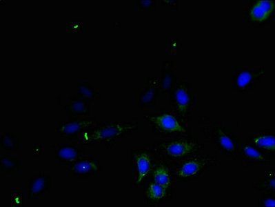 Protransforming growth factor alpha antibody