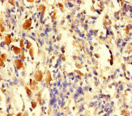 TGFA Antibody
