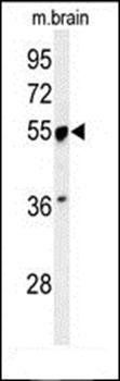 PRPF19 antibody