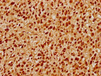 PRPF39 Antibody