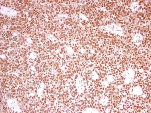 PRPF39 antibody [N2C1], Internal