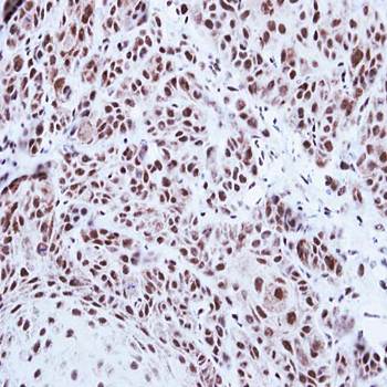 PRPF39 antibody
