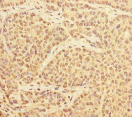 PRPF4 Antibody