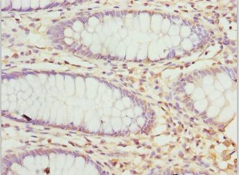 PRPH Antibody