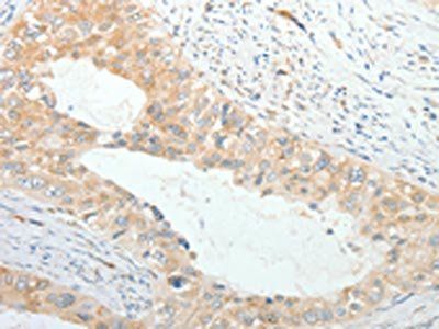 PRPH Antibody