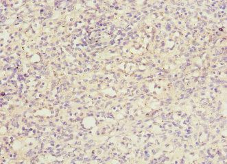 PRPS1 Antibody