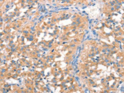 PRPS1/PRPS2/PRPS1L1 Antibody