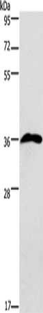 PRPS1/PRPS2/PRPS1L1 Antibody